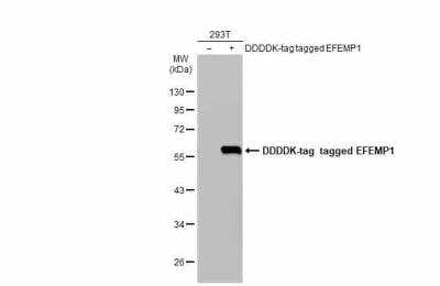 Western Blot: Fibulin-3/EFEMP1 Antibody [NBP2-16277]