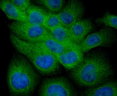 Immunocytochemistry/ Immunofluorescence: Fibulin 5/DANCE Antibody (2424) [NBP2-76929]