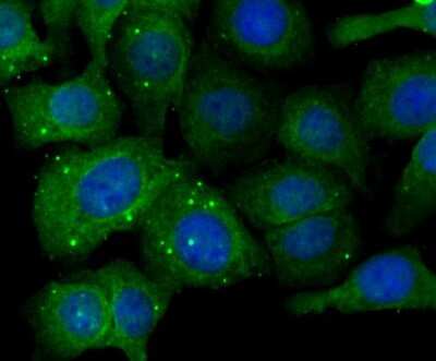 Immunocytochemistry/ Immunofluorescence: Fibulin 5/DANCE Antibody (2424) [NBP2-76929]