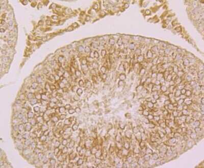 Immunohistochemistry: Fibulin 5/DANCE Antibody (2424) [NBP2-76929]