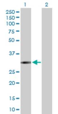 Western Blot: Ficolin-3 Antibody [H00008547-D01P]