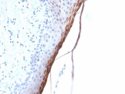 Immunohistochemistry-Paraffin: Filaggrin Antibody (FLG/1957R) - Azide and BSA Free [NBP3-08651]