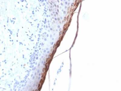 Immunohistochemistry-Paraffin: Filaggrin Antibody (FLG/1957R) [NBP3-07427]