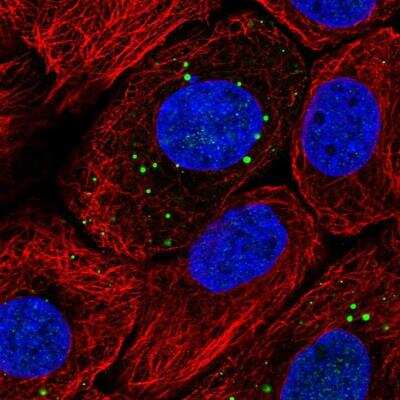 Immunocytochemistry/ Immunofluorescence: Filaggrin Antibody [NBP1-87528]