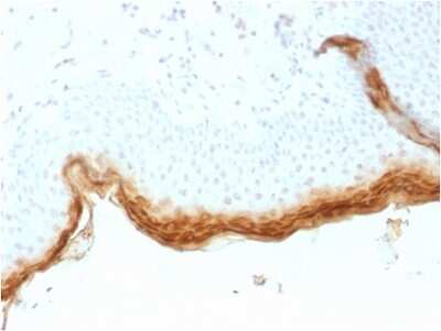 Immunohistochemistry-Paraffin: Filaggrin Antibody (rFLG/1561) [NBP3-07377]