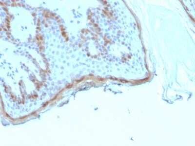Immunohistochemistry-Paraffin: Filaggrin Antibody (rFLG/1945) [NBP3-13892]