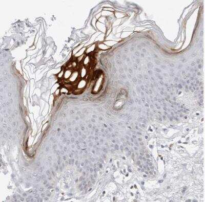 Immunohistochemistry-Paraffin: Filaggrin family member 2 Antibody [NBP1-91901]