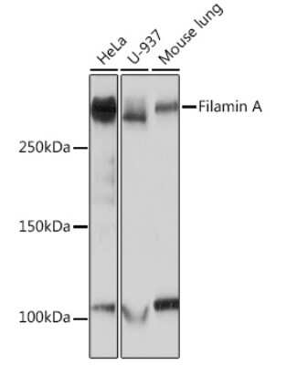 Western Blot: Filamin A Antibody (3X8Y9) [NBP3-16266]