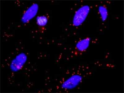 Proximity Ligation Assay: Filamin A Antibody (4E10-1B2) [H00002316-M01]