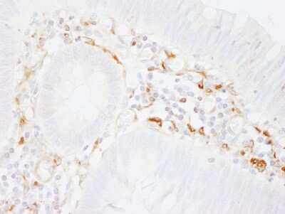 Immunohistochemistry: Filamin A Antibody [NB100-58813]
