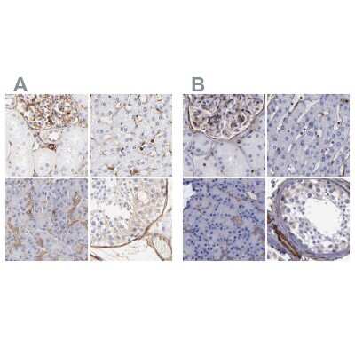 Immunohistochemistry-Paraffin: Filamin A Antibody [NBP1-90283]