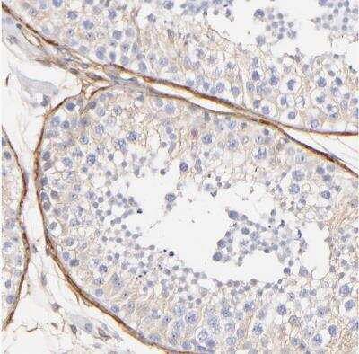 Immunohistochemistry-Paraffin: Filamin A Antibody [NBP1-90283]