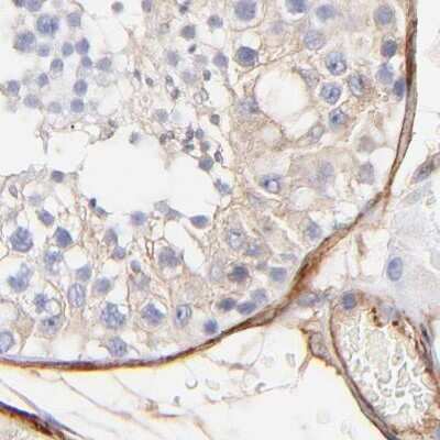 Immunohistochemistry-Paraffin: Filamin A Antibody [NBP1-90283]