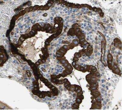 Immunohistochemistry-Paraffin: Filamin B Antibody [NBP1-90286]