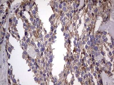 Immunohistochemistry: Filensin Antibody (OTI2B2) [NBP2-46572]