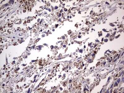 Immunohistochemistry: Filensin Antibody (OTI2B2) [NBP2-46572]