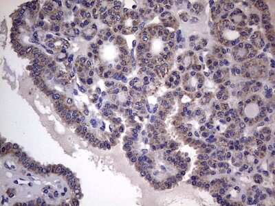 Immunohistochemistry: Filensin Antibody (OTI2B2) [NBP2-46572]