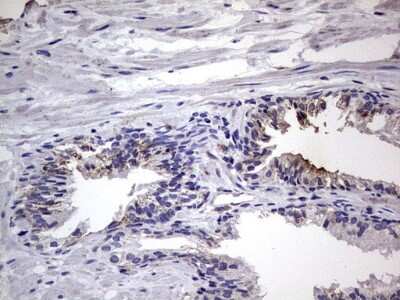 Immunohistochemistry: Filensin Antibody (OTI2B2) [NBP2-46572]