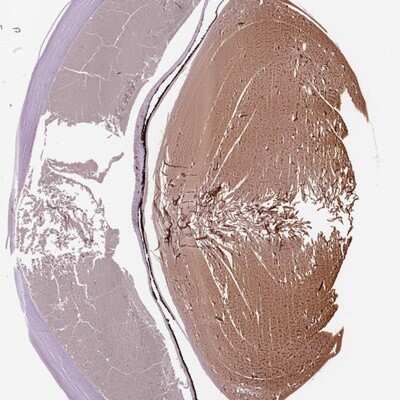 Immunohistochemistry-Paraffin: Filensin Antibody [NBP1-91902]