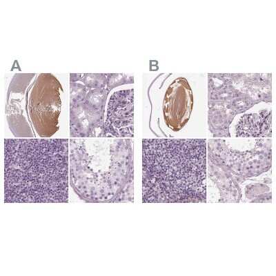 Immunohistochemistry-Paraffin: Filensin Antibody [NBP1-91902]