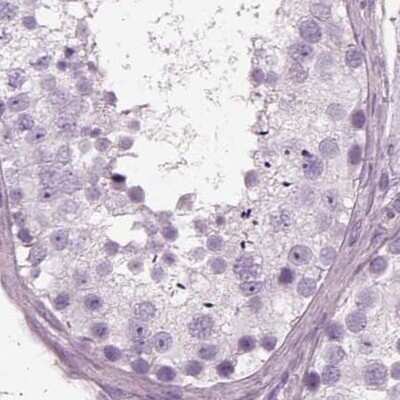 Immunohistochemistry-Paraffin: Filensin Antibody [NBP1-91902]