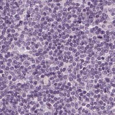 Immunohistochemistry-Paraffin: Filensin Antibody [NBP1-91902]