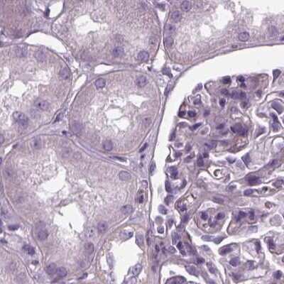 Immunohistochemistry-Paraffin: Filensin Antibody [NBP1-91902]