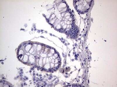 Immunohistochemistry: Filensin Antibody (OTI2B2) - Azide and BSA Free [NBP2-70249]