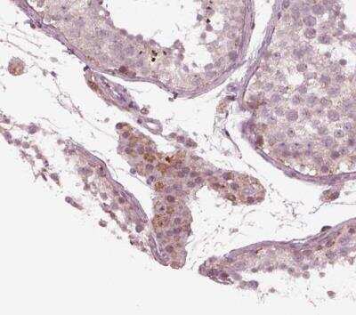 Immunohistochemistry-Paraffin: Flamingo homolog 1/CELSR3 Antibody [NBP2-38975]