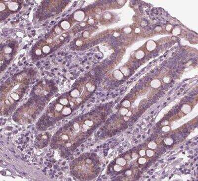 Immunohistochemistry-Paraffin: Flamingo homolog 1/CELSR3 Antibody [NBP2-38975]