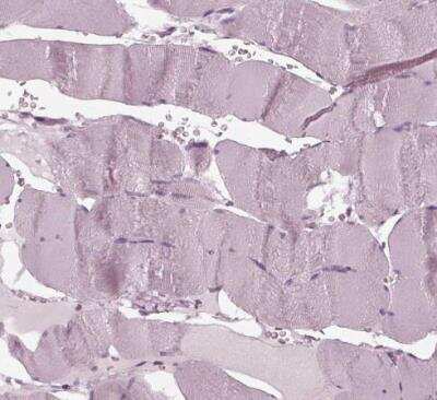 Immunohistochemistry-Paraffin: Flamingo homolog 1/CELSR3 Antibody [NBP2-38975]