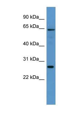 Western Blot: Flavin containing monooxygenase 4 Antibody [NBP1-69026]