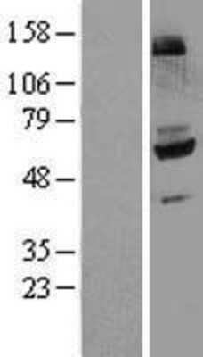 Western Blot: Flavin containing monooxygenase 4 Overexpression Lysate [NBL1-10777]