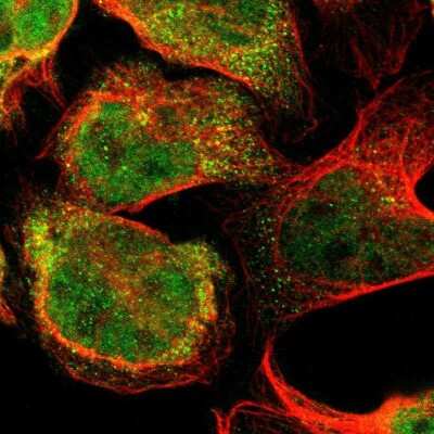Immunocytochemistry/ Immunofluorescence: Flightless I Antibody [NBP1-87925]