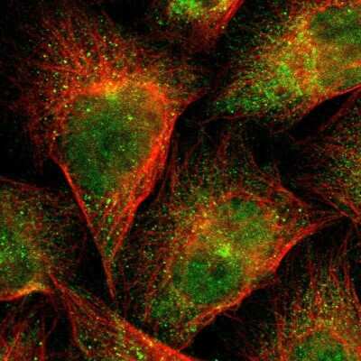 Immunocytochemistry/ Immunofluorescence: Flightless I Antibody [NBP1-87926]
