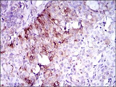 Immunohistochemistry-Paraffin: Flt-3/Flk-2/CD135 Antibody (7B7C3) - BSA Free [NBP2-37363]