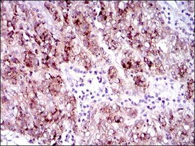 Immunohistochemistry-Paraffin: Flt-3/Flk-2/CD135 Antibody (7B7C3) - BSA Free [NBP2-37363]