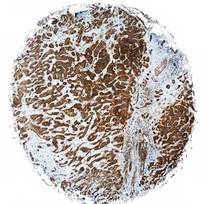 Immunocytochemistry: Flt-3/Flk-2/CD135 Antibody (7E8.2C8) - Azide and BSA Free [NBP2-80739]