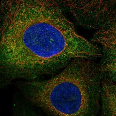 Immunocytochemistry/ Immunofluorescence: Flt-3/Flk-2/CD135 Antibody [NBP2-57187]