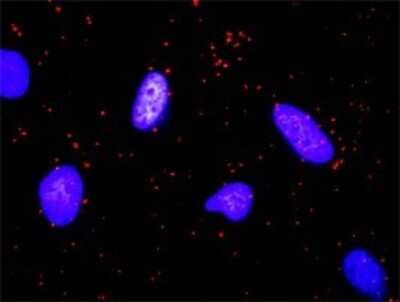 Proximity Ligation Assay: Flt-3 Ligand/FLT3L Antibody (4C4) [H00002323-M07]