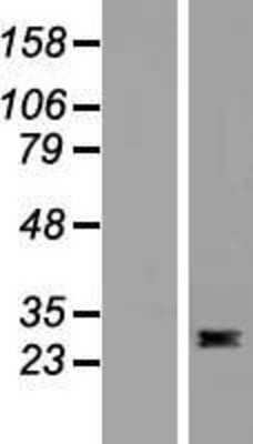 Western Blot: Flt-3 Ligand/FLT3L Overexpression Lysate [NBP2-10975]