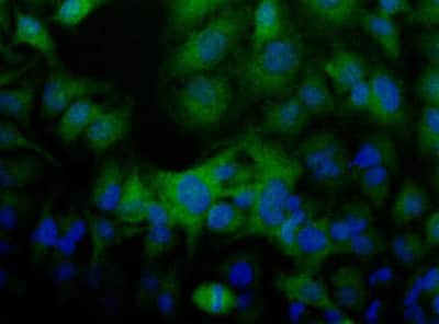Immunocytochemistry/ Immunofluorescence: Folliculin Antibody [NBP1-44995]