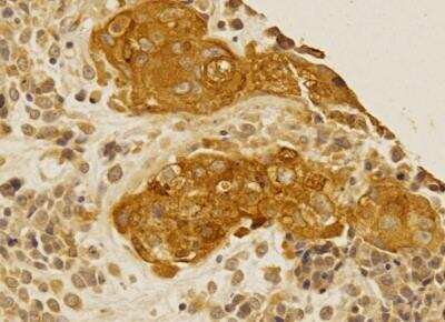 Immunohistochemistry-Paraffin: Folliculin Antibody [NBP1-44995]