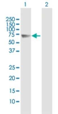 Western Blot: Follistatin-like 4/FSTL4 Antibody [H00023105-B01P]
