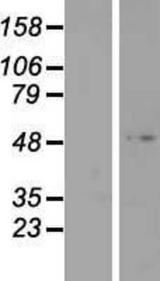 Western Blot: Forkhead box D4-like 3 Overexpression Lysate [NBP2-04670]