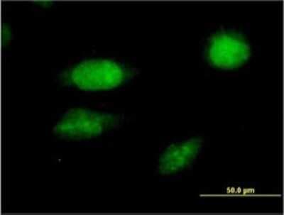 Immunocytochemistry/ Immunofluorescence: FoxC2 Antibody (2H3) [H00002303-M02]