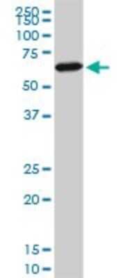 Western Blot: FoxC2 Antibody (3E6) [H00002303-M08]
