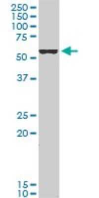 Western Blot: FoxC2 Antibody (3H5) [H00002303-M05]