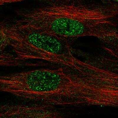 Immunocytochemistry/ Immunofluorescence: FoxF1 Antibody [NBP1-84670]
