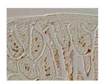 Immunohistochemistry: FoxF1 Antibody [NBP2-87469]